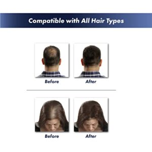 Full Head of Hair in 30 Seconds