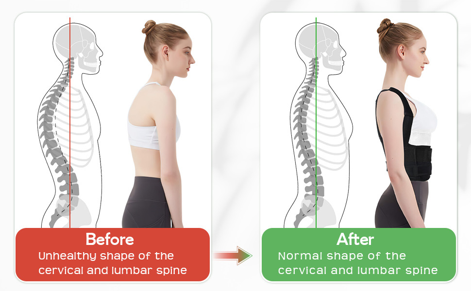 posture corrector