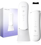Facial Skin Scrubber,ANLAN Electric Ultrasonic EMS Ion Face Cleanser Blackhead Remover Pores Clea...