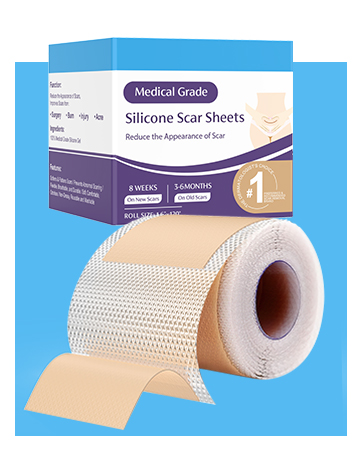 The best silicone scar sheets