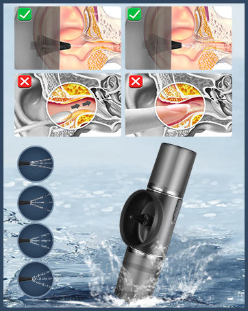 Ear Wax Removal Tool Electric Ear Cleaner Ear Cleaning Kit Earwax Removal Kit Ear Irrigation System
